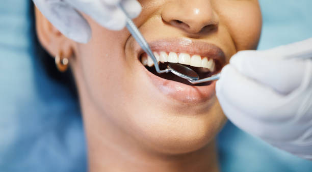 Best Emergency Wisdom Tooth Extraction in Arden Hills, MN