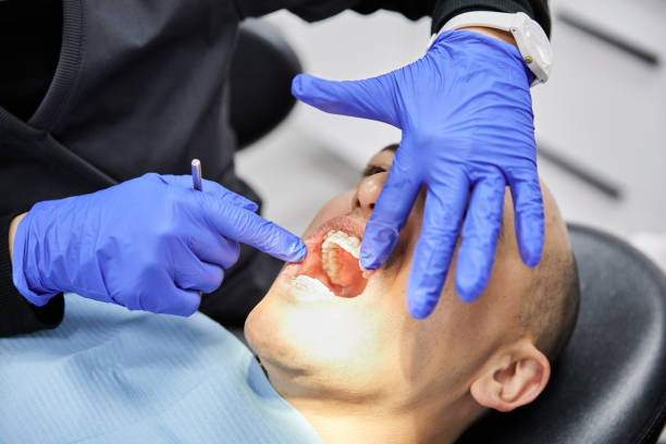 Best Knocked-Out Tooth (Avulsed Tooth) Treatment in Arden Hills, MN