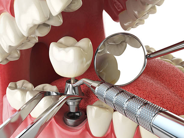 Best Walk-In Emergency Dental Services in Arden Hills, MN
